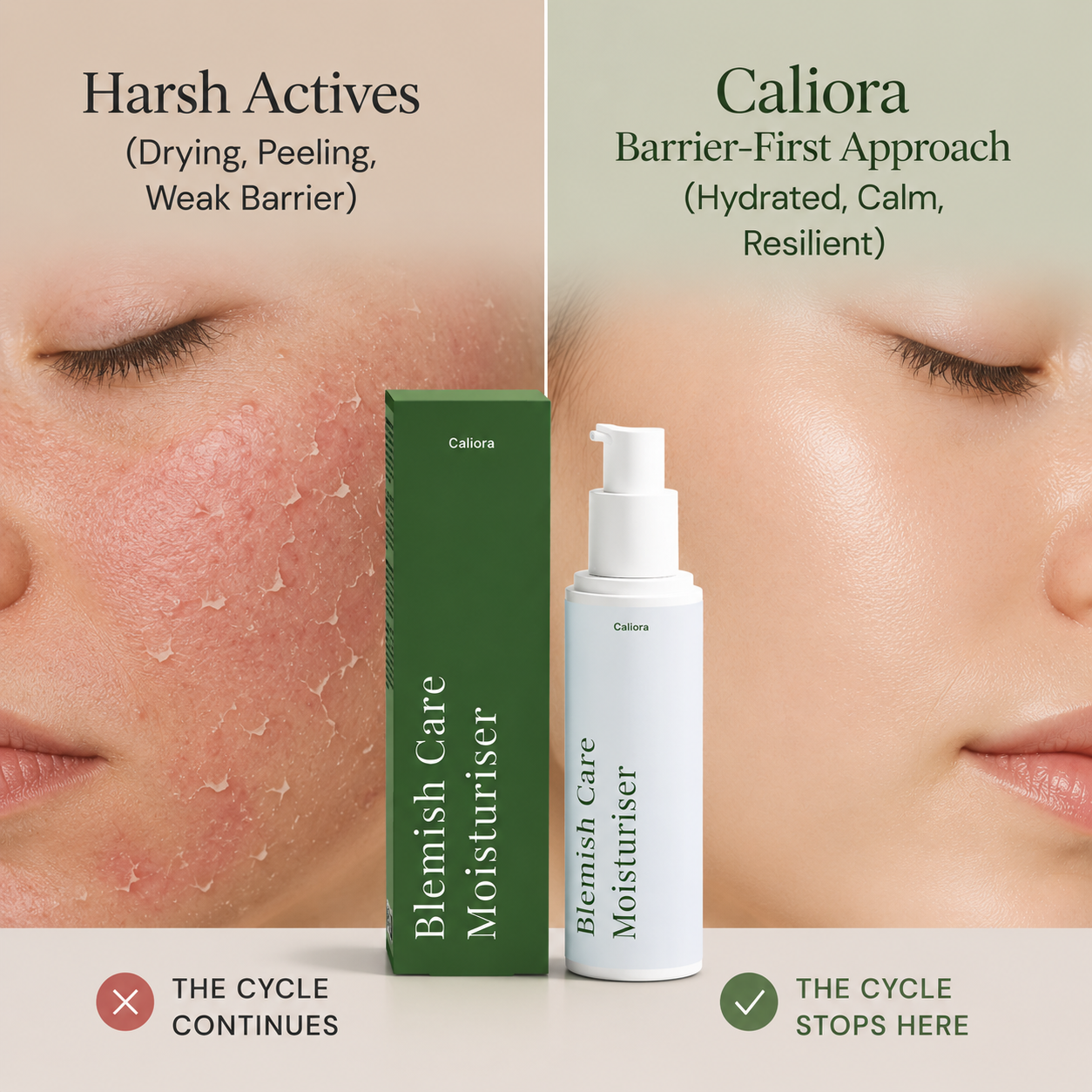 Blemish Care Moisturiser